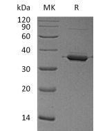 Recombinant Human ANXA2(Cat. No.:C205) novoprotein