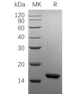 Recombinant Human OM (N-6His)(Cat. No.:C245) novoprotein