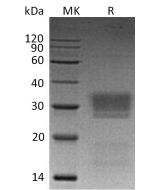 Recombinant Human NKG2DL2 (C-6His)(Cat. No.:C508) novoprotein