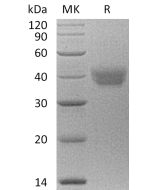 Recombinant Human ESAM (C-6His)(Cat. No.:C341) novoprotein