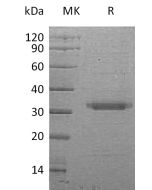 Recombinant Human BSSP-4 (C-6His)(Cat. No.:C383) novoprotein