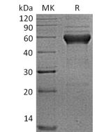 Recombinant Human ALK-1 (C-Fc)(Cat. No.:C422) novoprotein