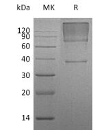 Recombinant Human GPC3 (C-6His)(Cat. No.:C414) novoprotein