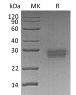 Recombinant Human CD32b (C-6His)(Cat. No.:C444) novoprotein