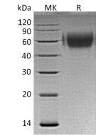 Recombinant Human MICA (C-6His)(Cat. No.:C489) novoprotein