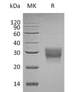 Recombinant Human CD8B (C-6His)(Cat. No.:C581) novoprotein