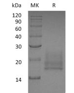 Recombinant Human CEACAM8 (C-6His)(Cat. No.:C583) novoprotein