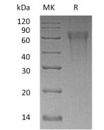 Recombinant Human CLM9 (C-6His)(Cat. No.:C576) novoprotein