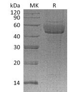 Recombinant Human SDC1 (C-6His)(Cat. No.:CA71) novoprotein