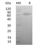 Recombinant Human RSPO3 (C-Fc-6His)(Cat. No.:CB79) novoprotein