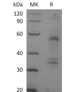 Recombinant Mouse HGF (C-6His)(Cat. No.:CC13) novoprotein