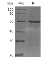 Recombinant Human IRF5 (C-6His)(Cat. No.:CF18) novoprotein