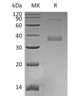 Recombinant Human MFAP4 (C-6His)(Cat. No.:CI81) novoprotein