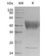 Recombinant Human IFNGR1 (C-6His)(Cat. No.:CI70) novoprotein