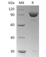 Recombinant Human KPNB1 (N-6His)(Cat. No.:CP58) novoprotein