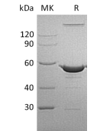 Recombinant Human NAMPT (N-6His)(Cat. No.:CP22) novoprotein