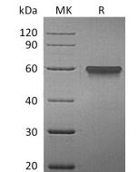 Recombinant Human 4-1BB (C-Fc)(Cat. No.:CP10) novoprotein