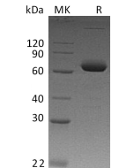Recombinant Human IL-2RB (C-Fc)(Cat. No.:CJ82) novoprotein
