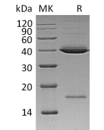 Recombinant Human Mindin (C-6His)(Cat. No.:CM63) novoprotein