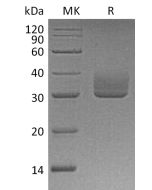 Recombinant Human ANGPTL3 (C-6His)(Cat. No.:CU43) novoprotein