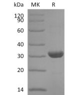 Recombinant Human NNT (N-6His)(Cat. No.:CR88) novoprotein