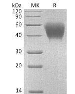 Recombinant Mouse SLAMF1 (C-6His)(Cat. No.:CS22) novoprotein