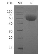 Recombinant Human IL-13RA1 (C-6His)(Cat. No.:CS32) novoprotein