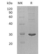 Recombinant Human PDIA5 (C-6His)(Cat. No.:CX96) novoprotein