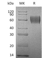 Recombinant Human IL-17RA (C-6His)(Cat. No.:CU97) novoprotein