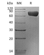 Recombinant Human PD-L2 (C-mFc)(Cat. No.:CW20) novoprotein