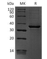 Recombinant Human FGL1 (C-6His)(Cat. No.:CW55) novoprotein