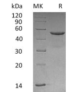 Recombinant Human CD99 (C-Fc)(Cat. No.:CX09) novoprotein