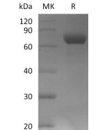 Biotinylated Human LILRB2 (C-Avi-6His)(Cat. No.:CY32) novoprotein