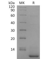 Recombinant Human CXCL5(Cat. No.:CF14) novoprotein
