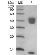 Recombinant Human Latent TGF Beta-1 (N-6His)(Cat. No.:CA72) novoprotein