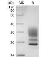 Recombinant Human CD3D&CD3E Heterodimer V2 (C-6His)(Cat. No.:C33F) novoprotein