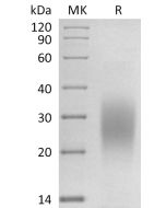 Recombinant Cynomolgus IL-13 (C-6His)(Cat. No.:C37G) novoprotein