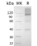 Recombinant Human GPC3 (C-Fc)(Cat. No.:CW66) novoprotein