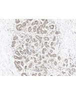Anti-Aha1/AHSA1 Antibody, Rabbit Polyclonal sinobiological 203523-T08