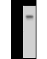Anti-CCDC66 Antibody, Rabbit Polyclonal sinobiological 201326-T32