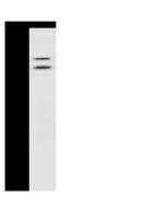Anti-COMP Antibody, Rabbit Polyclonal sinobiological 107328-T32