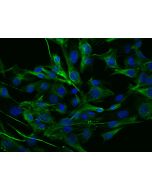 Anti-Desmin Antibody, Rabbit Polyclonal sinobiological 106974-T42