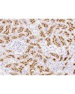 Anti-ACE2 Antibody, Rabbit Polyclonal sinobiological 10108-RP01
