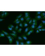 Anti-ACYP1 Antibody, Rabbit Polyclonal sinobiological 201777-T02