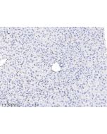 Anti-Cathepsin S Antibody, Rabbit Polyclonal sinobiological 50769-T24