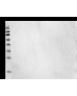Influenza A H9N2 (A/Hong Kong/1073/99) Neuraminidase / NA Antibody, Mouse MAb sinobiological 40040-MM02