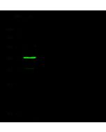 Anti-A4GALT Antibody, Rabbit Polyclonal sinobiological 100447-T32