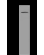 Anti-FOXO1 Antibody, Rabbit Polyclonal sinobiological 200239-T32