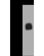 Monkeypox Virus (MPXV) A5L Antibody, Rabbit PAb, Antigen Affinity Purified sinobiological 40905-T62