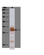 Influenza A H1N1 (A/Puerto Rico/8/34/Mount Sinai) Matrix protein 1 / M1 Antibody, Rabbit PAb, Antigen Affinity Purified sinobiological 40010-T62